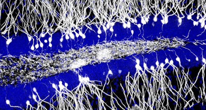 neurons in the brain