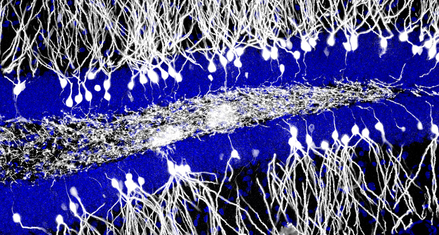 neurons in the brain