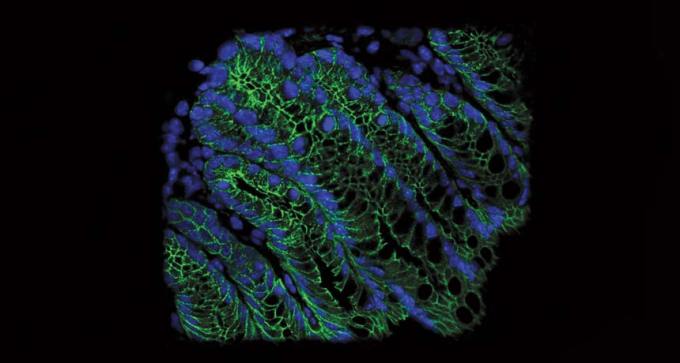 micrograph of cells in mouse colon