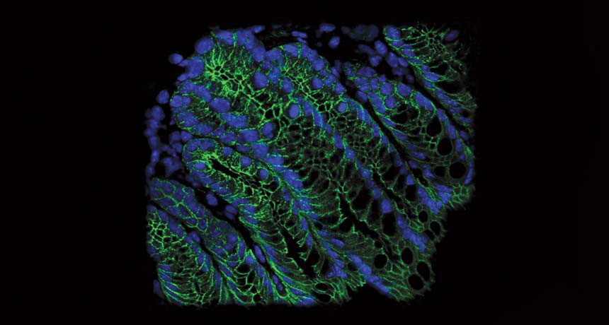 micrograph of cells in mouse colon