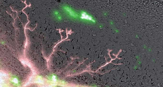 nerve cells from an eye