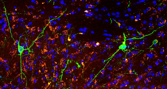 neurons in the lateral hypothalamus