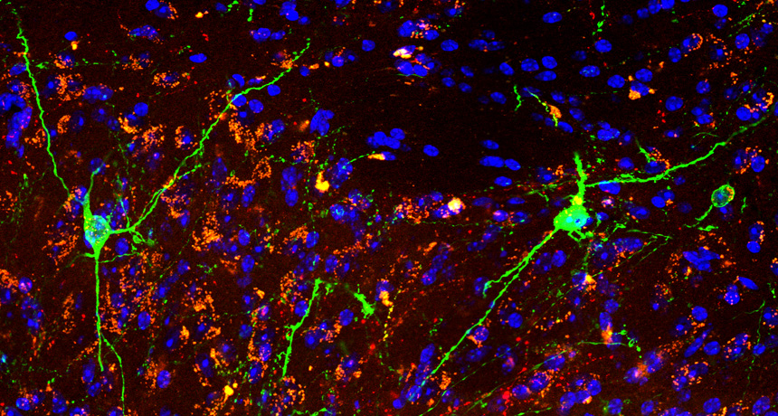 neurons in the lateral hypothalamus