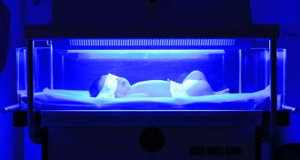 baby getting light therapy