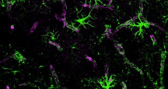 brain's plumbing system