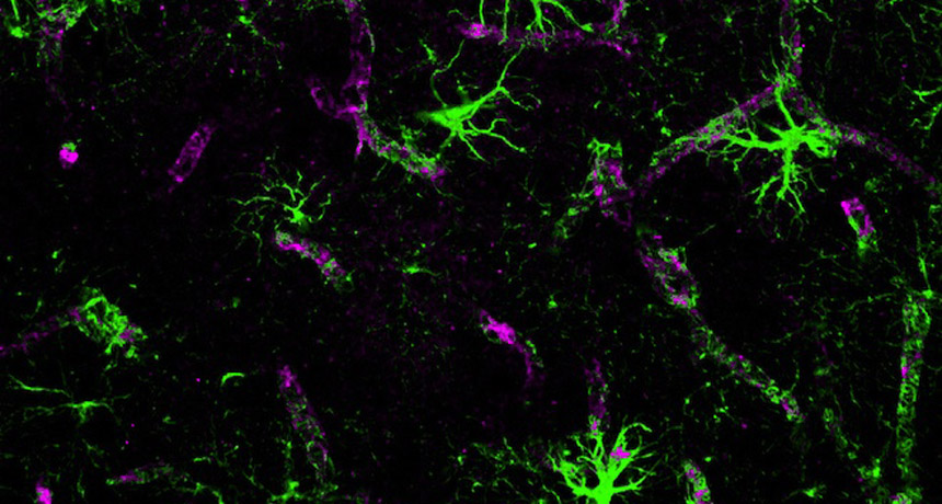 brain's plumbing system
