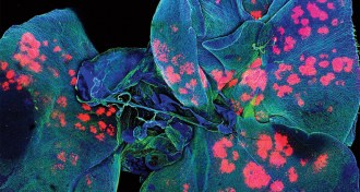 A micrograph of a mouse's lungs