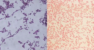 gram staining bacteria