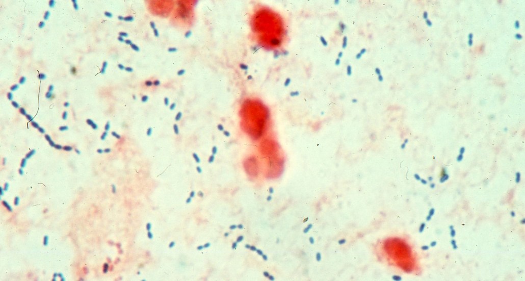 Streptococcus pneumoniae