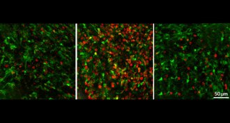 birth of neural stem cells