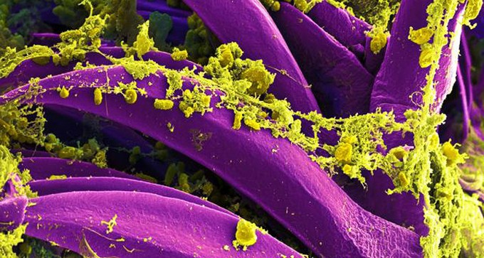 Yersinia pestis bacteria