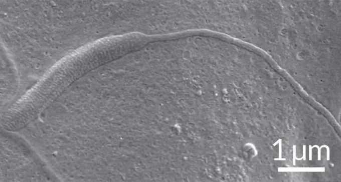ancient sperm