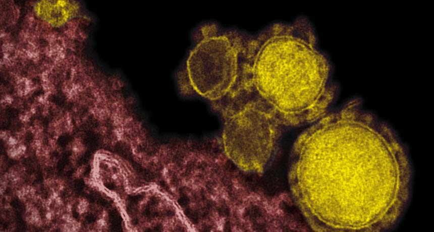 MERS virus (yellow)