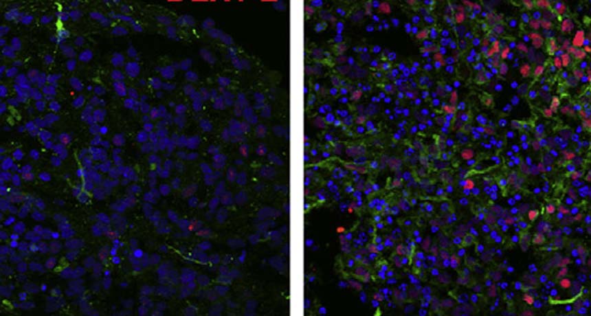 Brainlike structures
