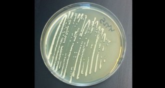 petri dish of yeast