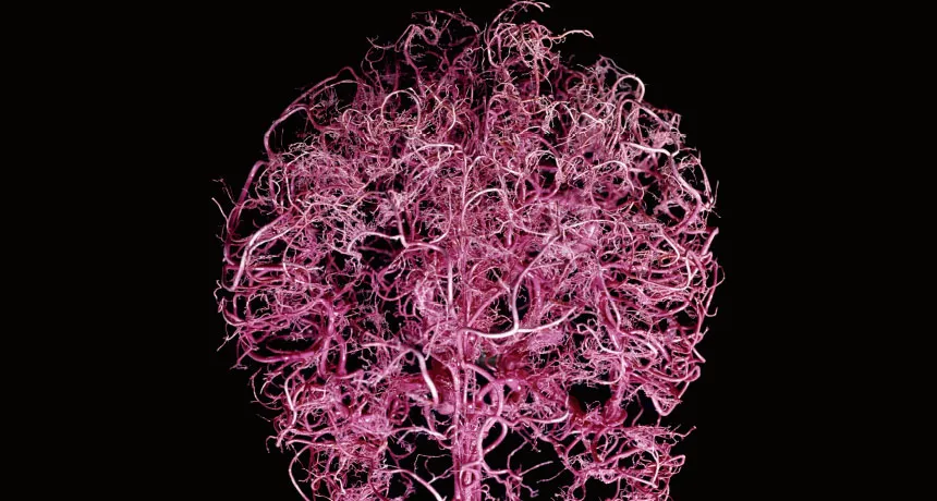 brain blood vessels