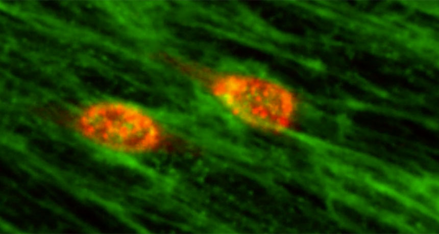 head and neck cancer cells
