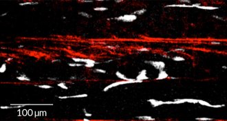 Ghost fibers and stem cells