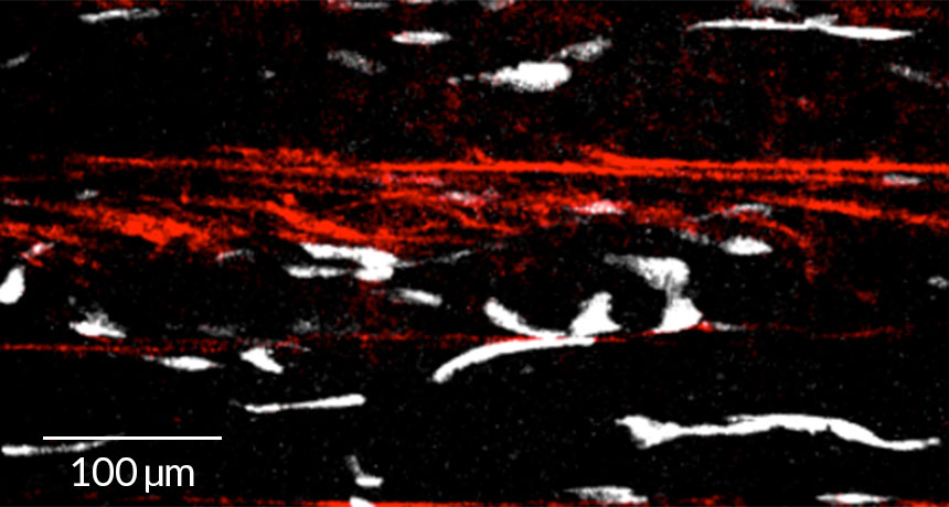 Ghost fibers and stem cells