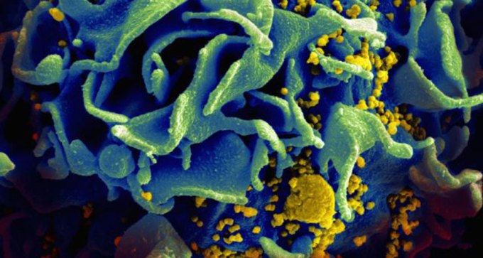 HIV infecting an immune cell