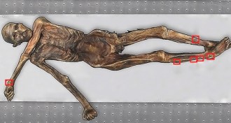 Ötzi the Iceman