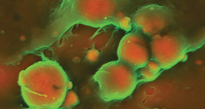 microscope image of plaques in a human artery