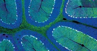 cross-section of a mouse brain