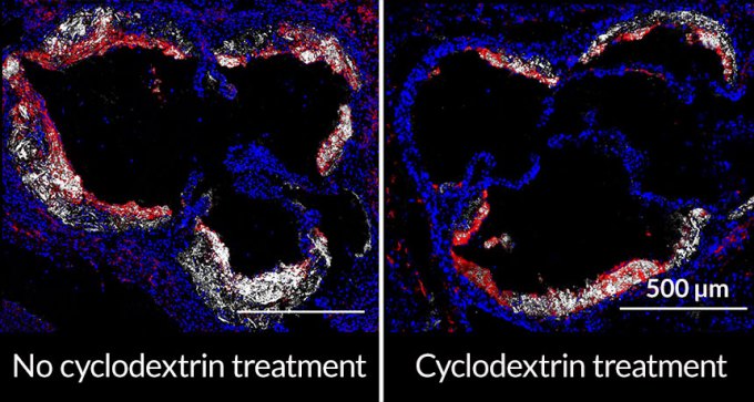 cholesterol crystals in mouse arteries