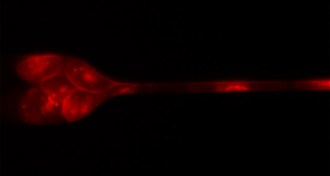 magnified image of cells squeezing through a capillary