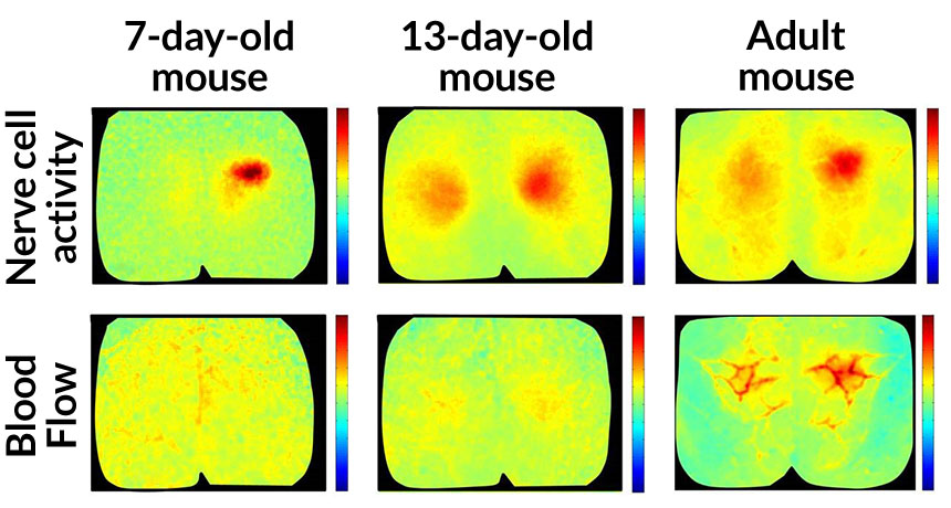 mouse nerve cell stimulation