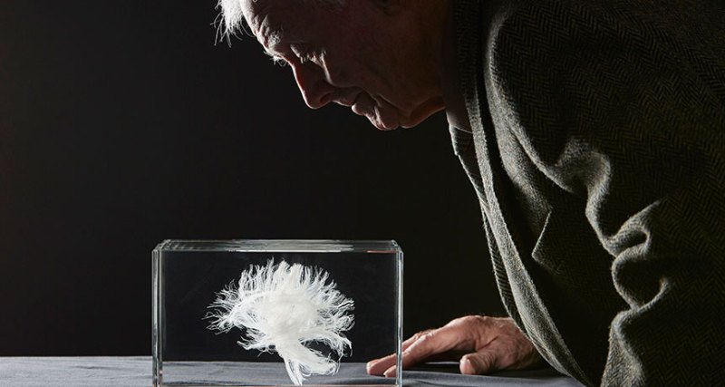 John Scott looks at a model of his white matter tracts