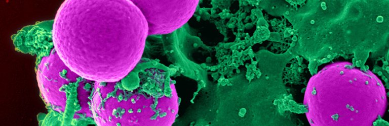 Staphylococcus lugdunensis and MRSA
