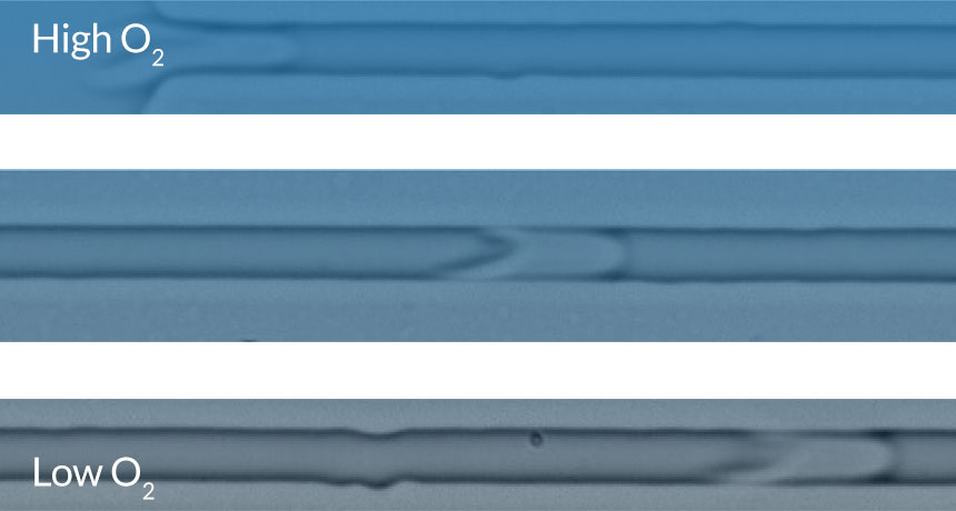 images of blood cells in capillaries