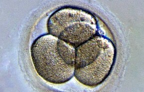 human embryo