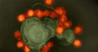Zika virus