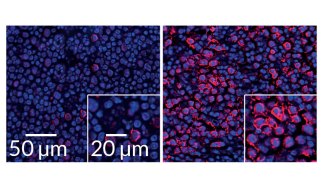 interferon in B cells