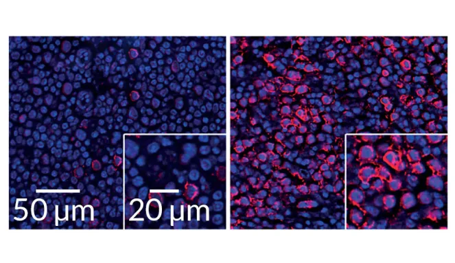 interferon in B cells