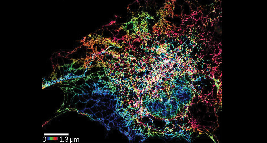 Endoplasmic reticulum