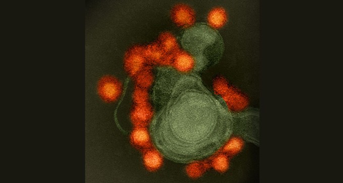 TEM of Zika virus