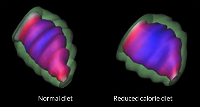 MRI of baboon hearts