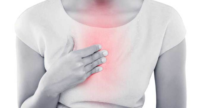heartburn