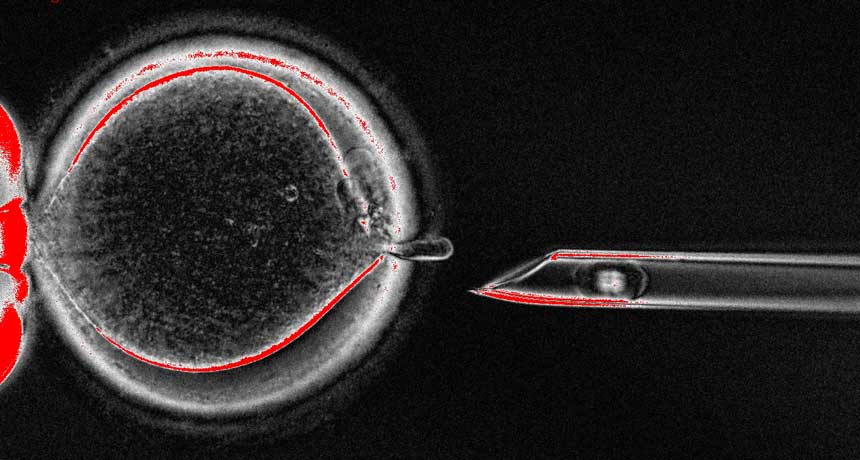 needle with spindle and egg