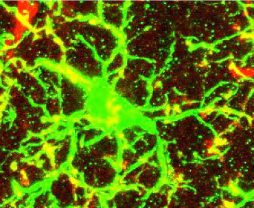 microglia versus amyloid-beta
