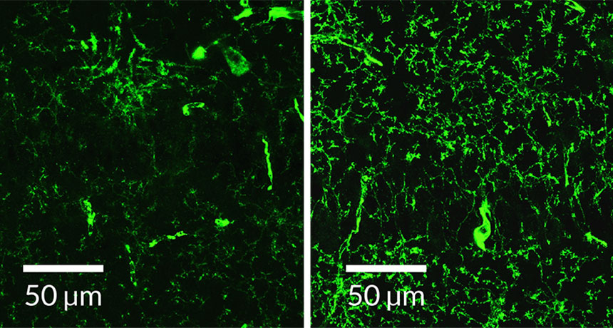 amyloid-beta comparison