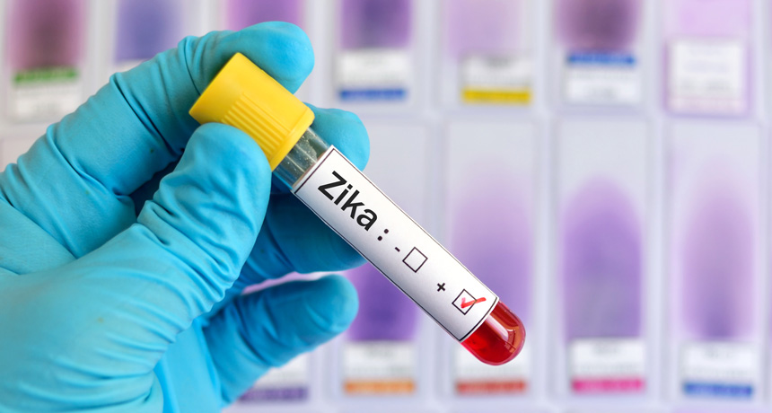 vial labeled zika