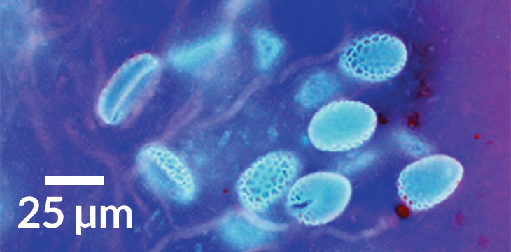 pollen tubes in lillies