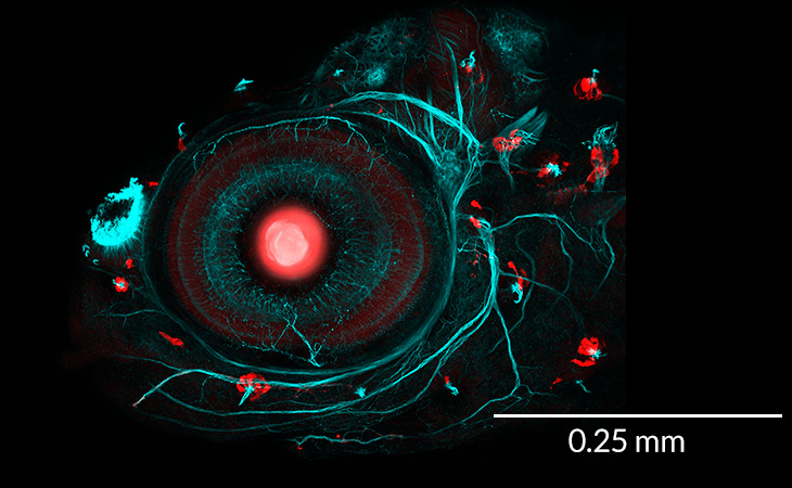 zebrafish eye
