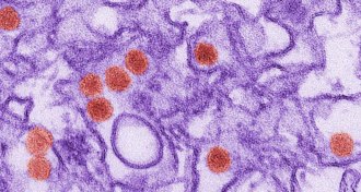 Zika virus