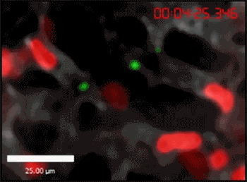 neutrophils and E. coli