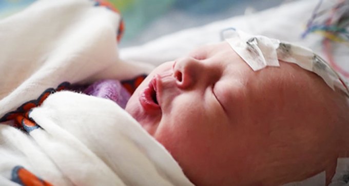 newborn baby wearing electrodes